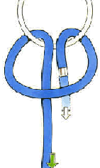 Ankerstich